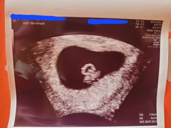 Bild zu Erster US - Forum für Juli - Mamis