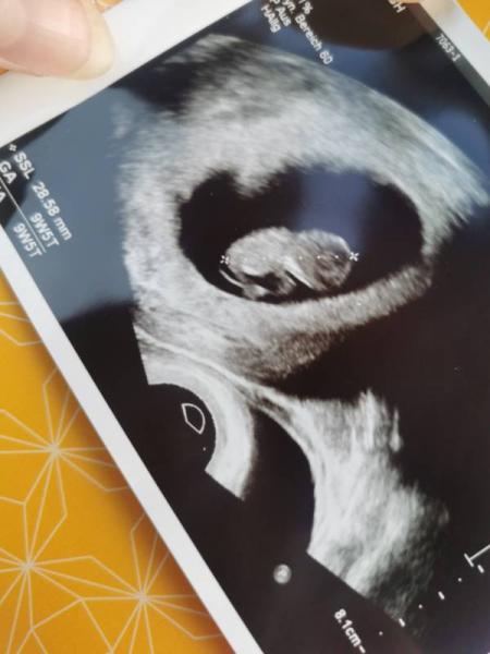 Bild zu US bei 9+6 und Mutterpass - Forum für Juli - Mamis