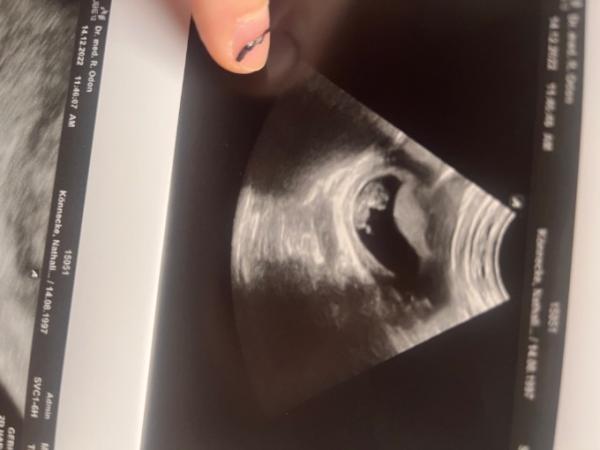 Bild zu Große untersuchung - Forum für Juli - Mamis