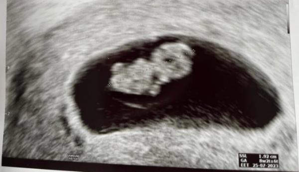 Bild zu Welches Geschlecht nach Ramzi-Methode? - Forum für Juli - Mamis