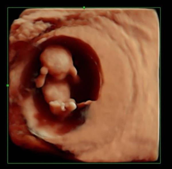 Bild zu Zurück von US 🥰 - Forum für Juli - Mamis