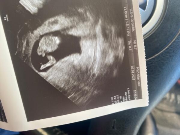 Bild zu Nubexperten gesucht - Forum für Juli - Mamis
