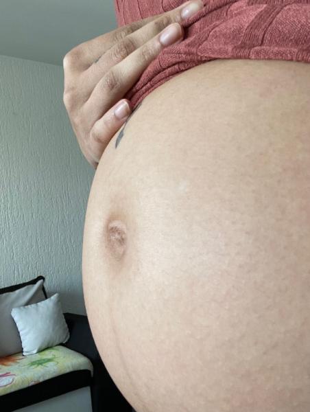 Bild zu Jetzt schon Linea Nigra und Bauchnabel nach außen?? - Forum für Juli - Mamis