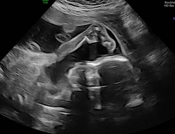 Bild zu Organscreening heute - Forum für Juli - Mamis