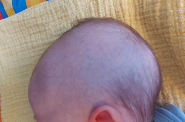 Bild zu Haare verabschieden sich - Forum für Juli - Mamis