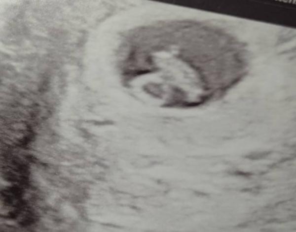 Bild zu Attest geholt plus bauchschallung - Forum für Juli - Mamis