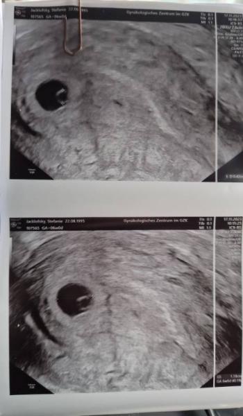 Bild zu Erster US Termin - Forum für Juli - Mamis