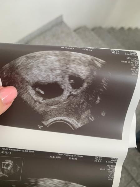 Bild zu Aus der KIWUKlinik entlassen - Forum für Juli - Mamis