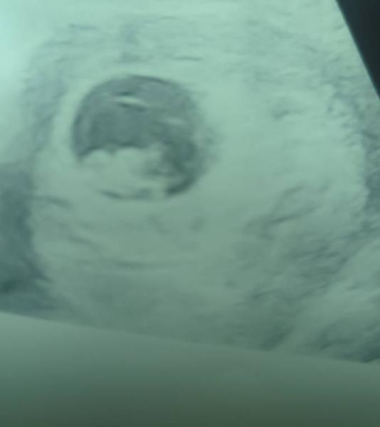 Bild zu Kontrolle wieder :) - Forum für Juli - Mamis