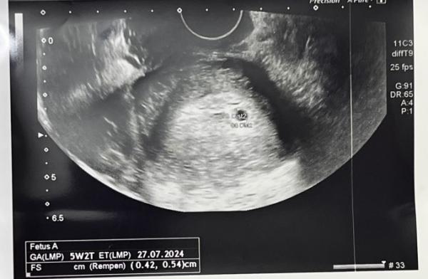 Bild zu Erster Us 5+2 - Forum für Juli - Mamis