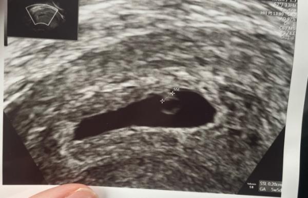 Bild zu Erster ultraschall - Forum für Juli - Mamis