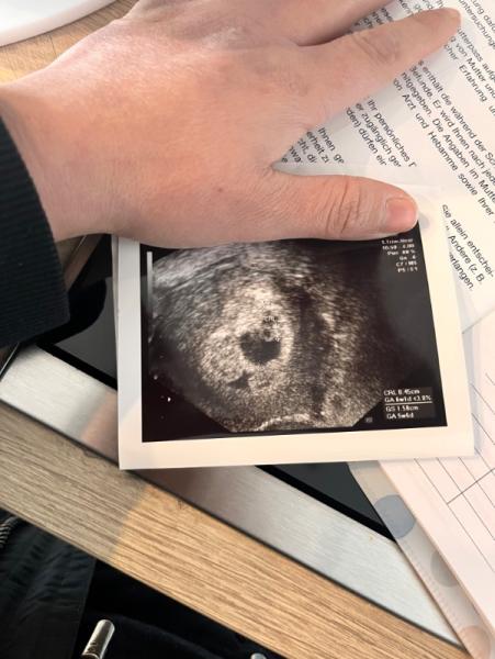 Bild zu Das Herz schlägt 💓 - Forum für Juli - Mamis