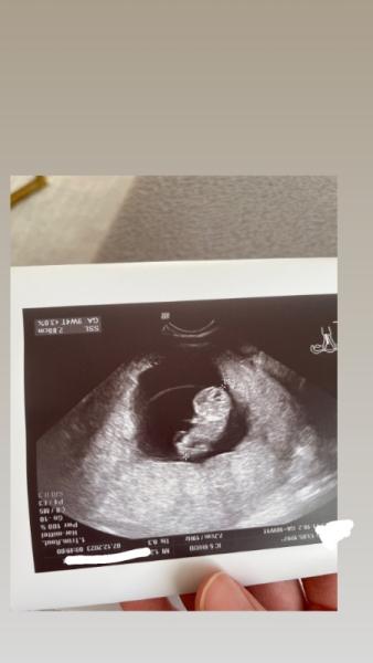 Bild zu 2. US 😍 - Forum für Juli - Mamis