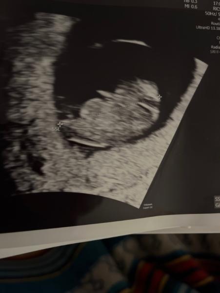 Bild zu Ich komme aus dem August zu euch - Forum für Juli - Mamis