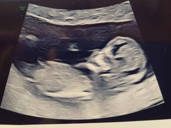Bild zu Nub? - Forum für Juli - Mamis