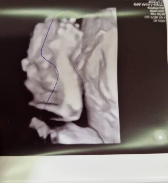 Bild zu 2 großer Ultraschall - Forum für Juli - Mamis