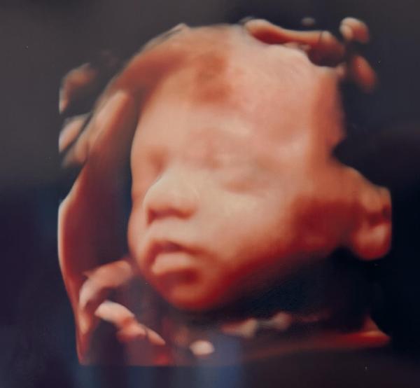 Bild zu Wie geht's euch denn so? - Forum für Juli - Mamis