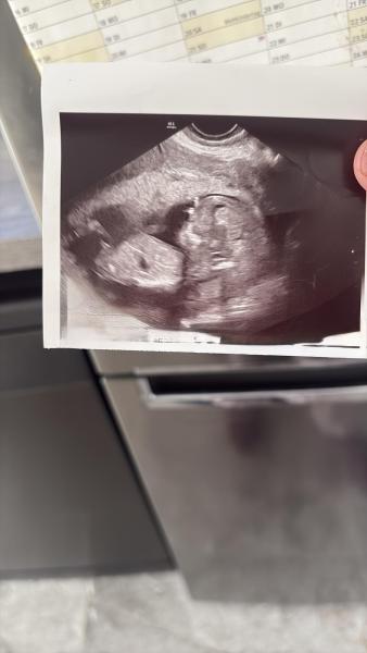 Bild zu Junge oder Mädchen - Forum für Juli - Mamis