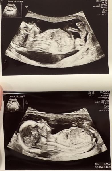 Bild zu Mädchen oder Junge? - Forum für Juli - Mamis