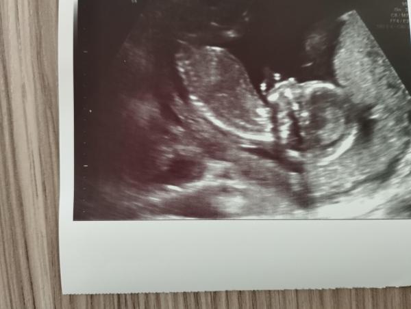 Bild zu Geschlecht - Forum für Juli - Mamis