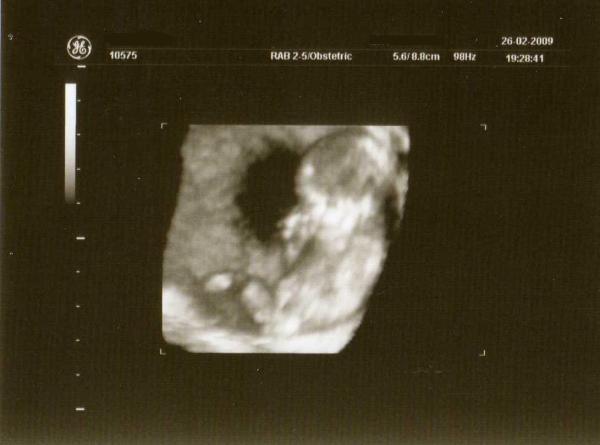 Bild zu Noch ein Bild - Forum für August - Mamis