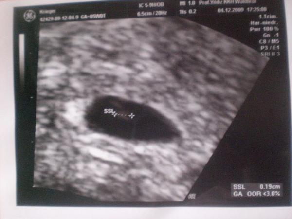 Bild zu Jetzt schaff ich es endlich unser erstes US Bild zu zeigen - Forum für August - Mamis