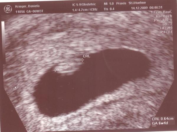 Bild zu Erste Vu gehabt - Forum für August - Mamis