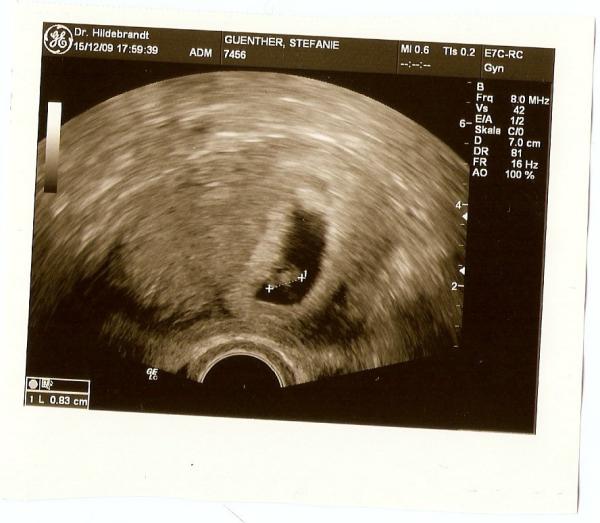 Bild zu Bericht FA und ein schönes Bild vom Krümel!! - Forum für August - Mamis