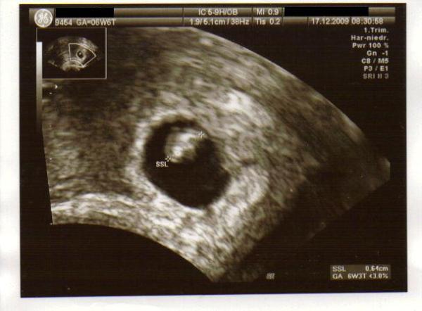 Bild zu Gerade vom Doc zurück =) - Forum für August - Mamis