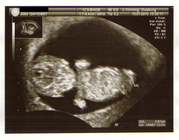 Bild zu Zurück von der VU =) (bissl länger) - Forum für August - Mamis