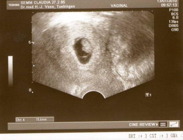 Bild zu war gestern beim FA... - Forum für August - Mamis