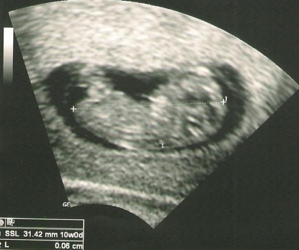 Bild zu Mein Baby... - Forum für August - Mamis