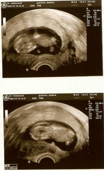 Bild zu Gestern Fa-Besuch...alles okay...aber... - Forum für August - Mamis