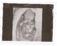 Bild zu VU& erstes 3d Bild - Forum für August - Mamis