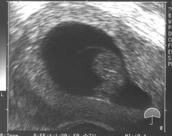 Bild zu Bin auch mal wieder da + Bild - Forum für August - Mamis