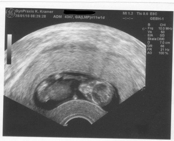 Bild zu heute VU + die lange versprochenen Bilder - Forum für August - Mamis