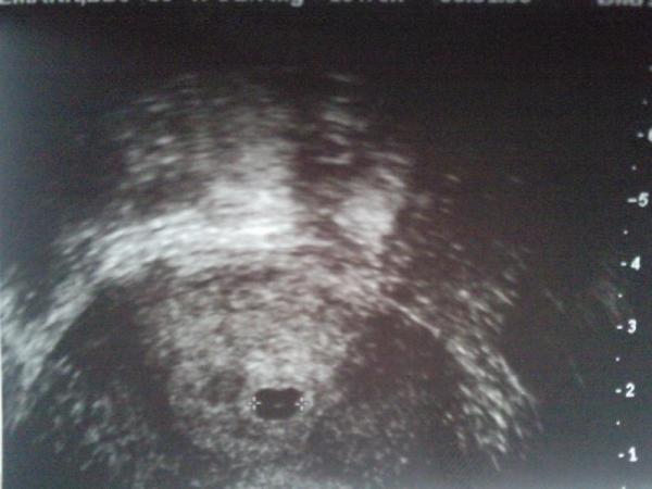 Bild zu Bilder :-) - Forum für August - Mamis