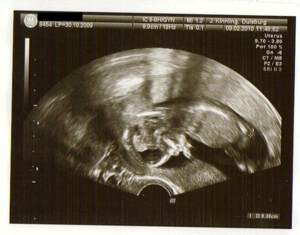 Bild zu Zurück von der VU =) - Forum für August - Mamis