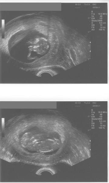 Bild zu Heute VU... - Forum für August - Mamis