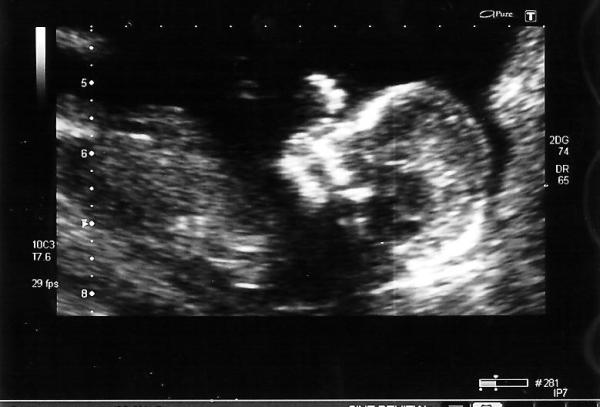 Bild zu Ist es nicht herrlich :-) ?! - Forum für August - Mamis