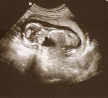 Bild zu ZUrück von VU +Bild - Forum für August - Mamis