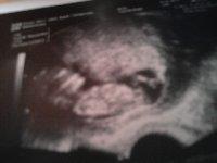 Bild zu habe noch schnell nen bild abfotografiert:) - Forum für August - Mamis