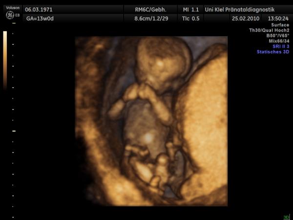 Bild zu Wollt Ihr mal das Baby sehen? - Forum für August - Mamis