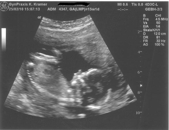 Bild zu VU von gestern + Bild - Forum für August - Mamis