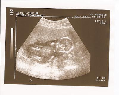 Bild zu Vu gehabt+Bild - Forum für August - Mamis
