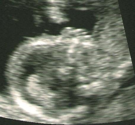 Bild zu Das Gesicht von meinen Baby - Forum für August - Mamis