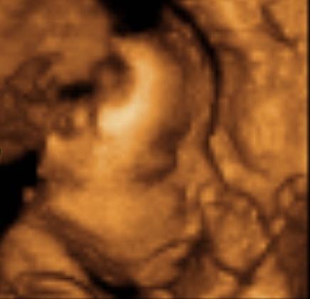 Bild zu Outing und 3D Ultraschall - Forum für August - Mamis