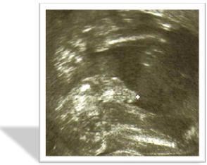 Bild zu 2.Ultraschall und VS - Forum für August - Mamis