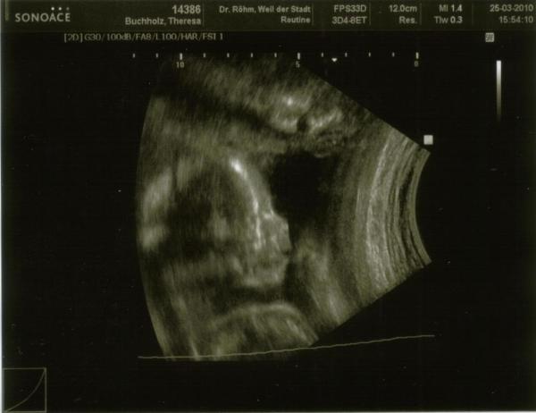 Bild zu Wie versprochen - das Ultraschallbild - Forum für August - Mamis