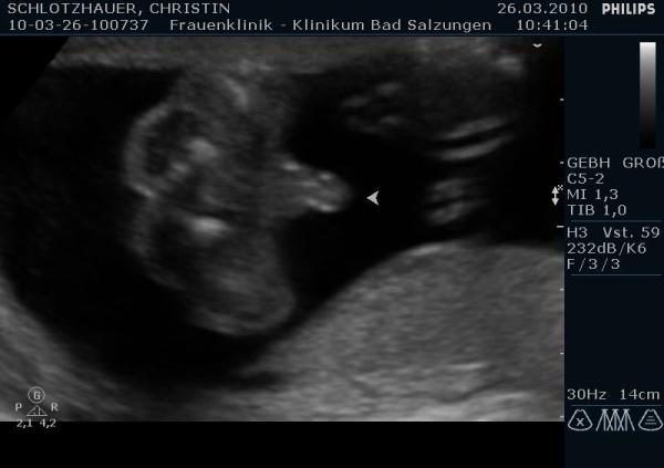 Bild zu FD gehabt und endlich Outing :-) - Forum für August - Mamis